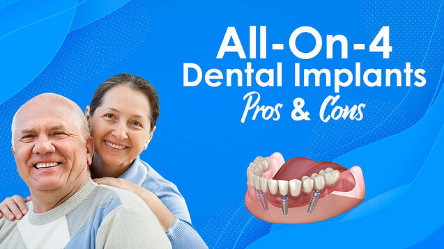 All On 4 Dental Implants Pros & Cons