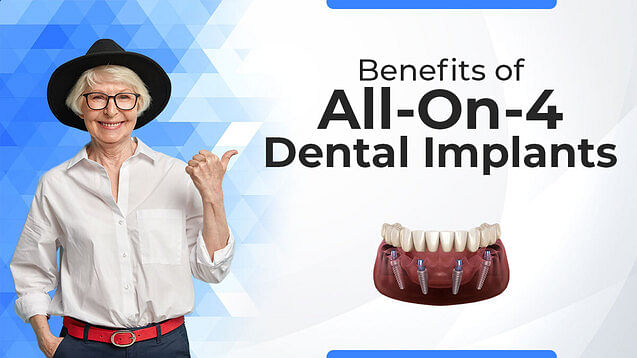 Benefits of All-On-4 Dental Implants!